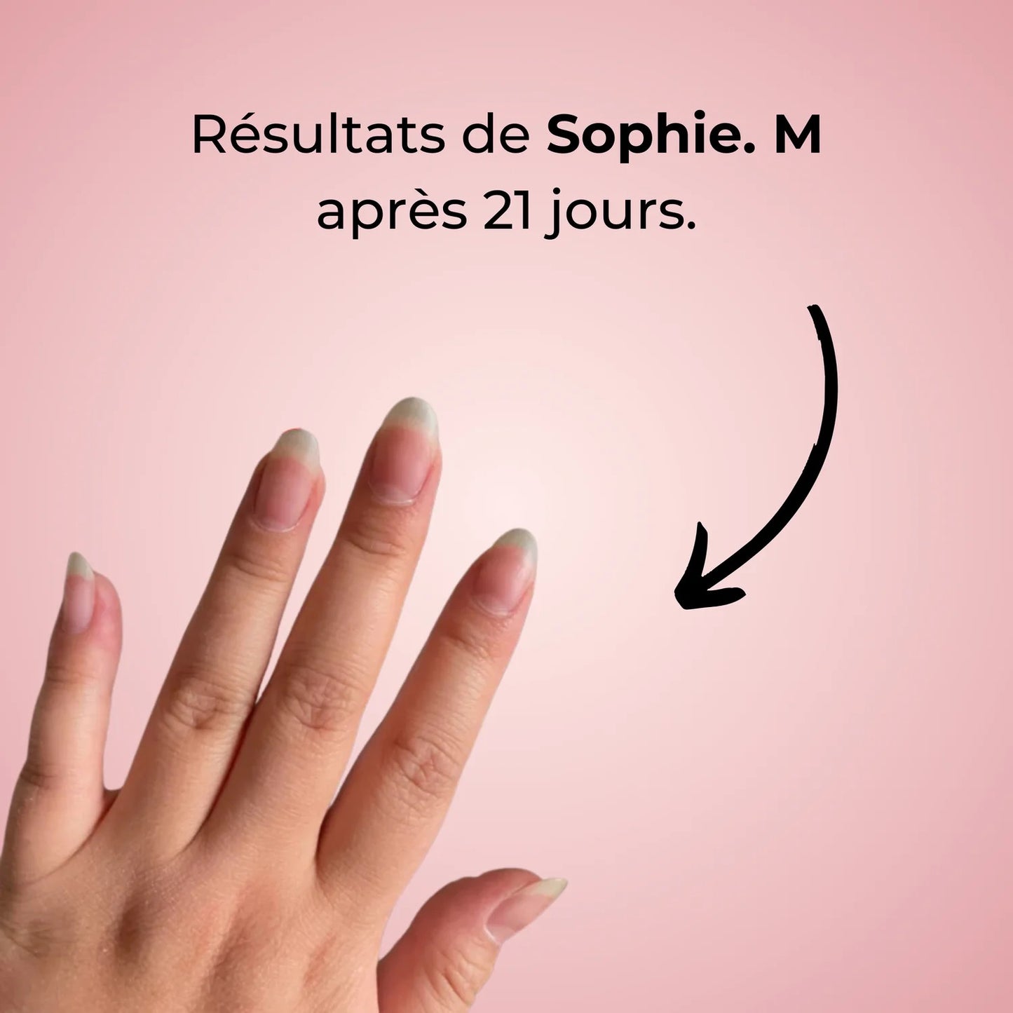 🌸 Sérum de Croissance pour Ongles