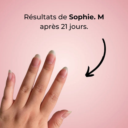 🌸 Sérum de Croissance pour Ongles