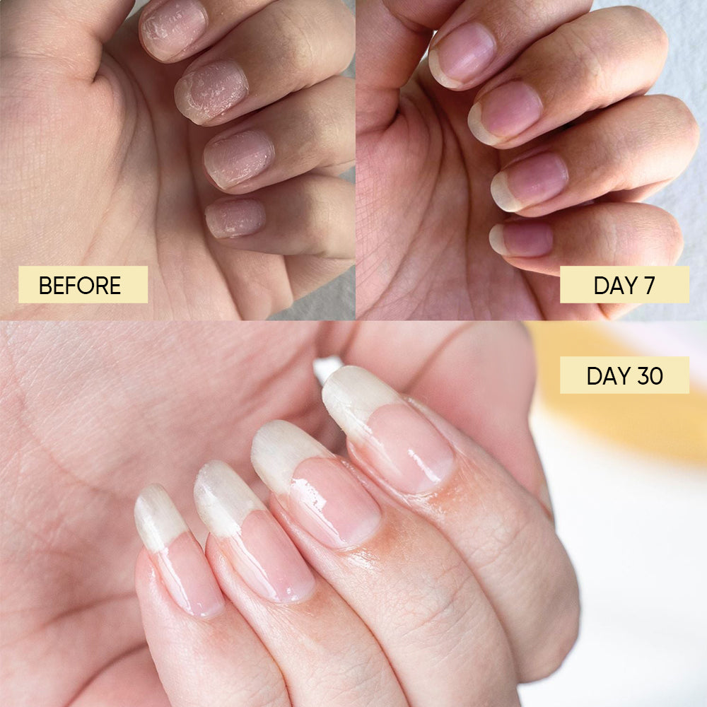🌸 Sérum de Croissance pour Ongles